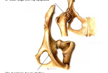 Hip Dysplasia