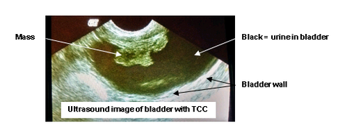 what is transitional cell carcinoma in dogs